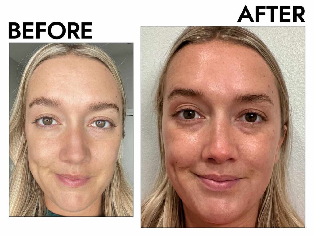 best skin firming cream best skin firming cream